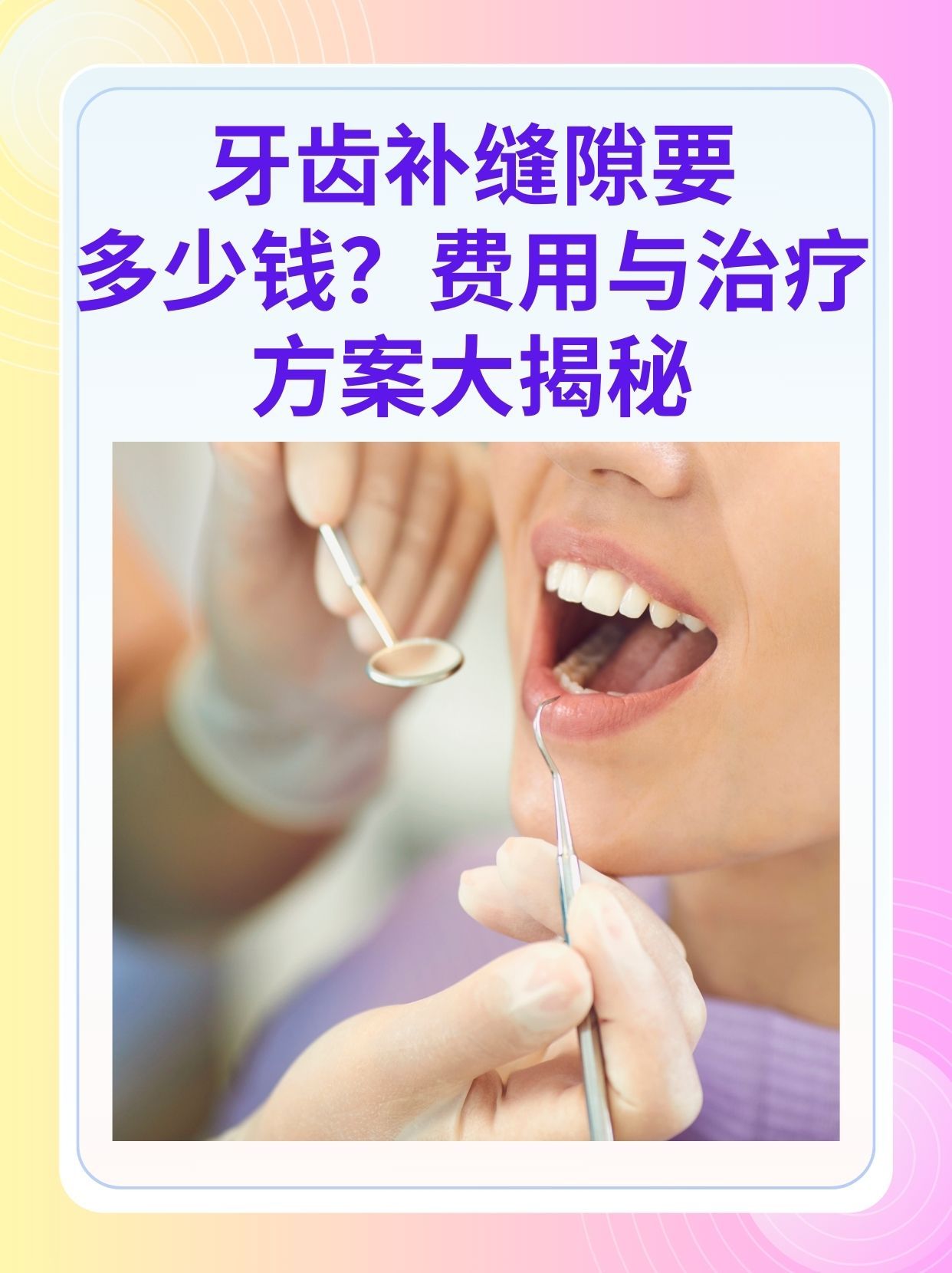 济宁补牙医保可以报销吗(补牙医保可以报销吗 哪些可以报销呢)